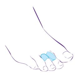 СТ-54.6 (L) Перегородка межпальцевая с протектором,совмещенная с протектором сустава